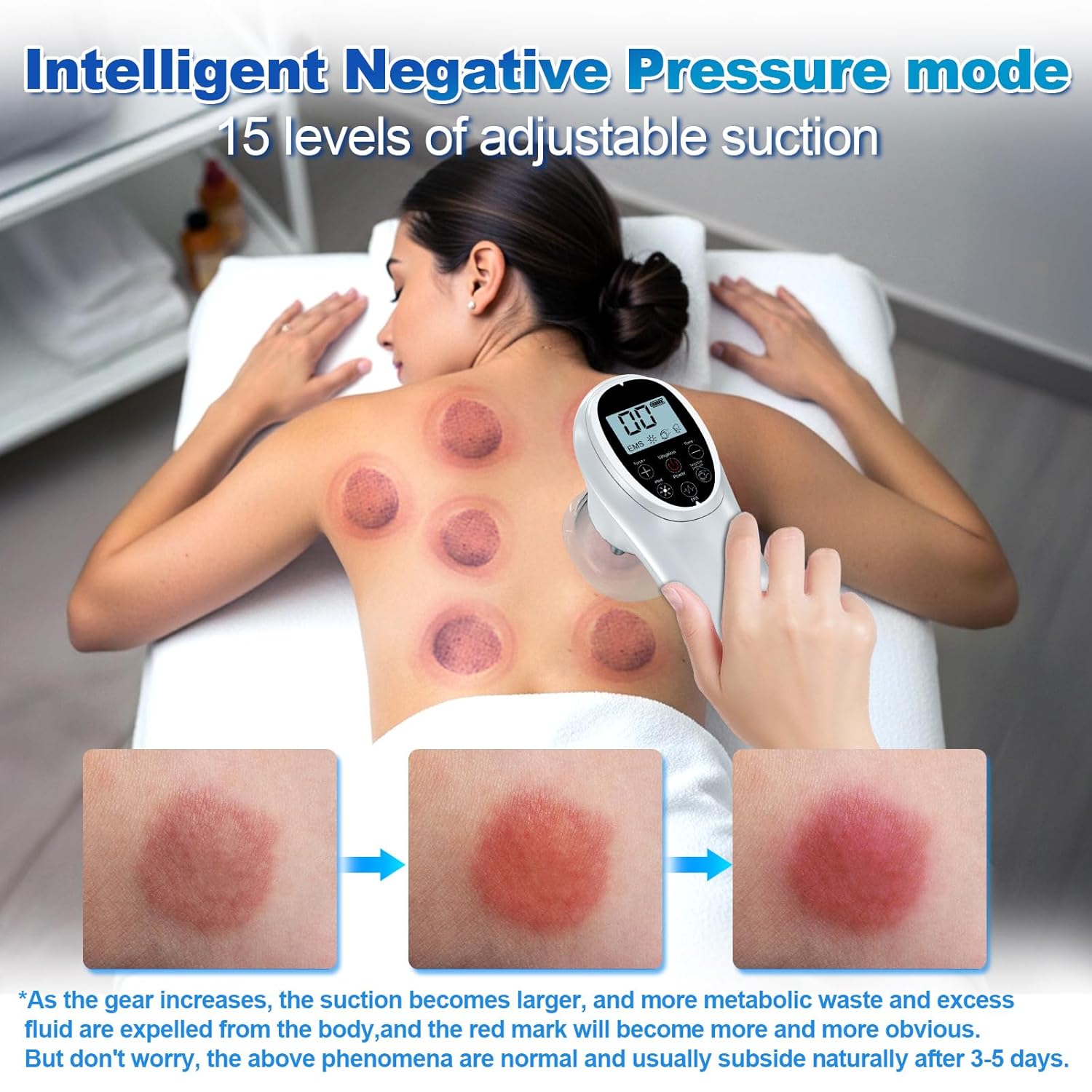 Rkdely 5-in-1 Cupping-Massager: EMS, Rotlicht-Wärme für Cellulite-Behandlung