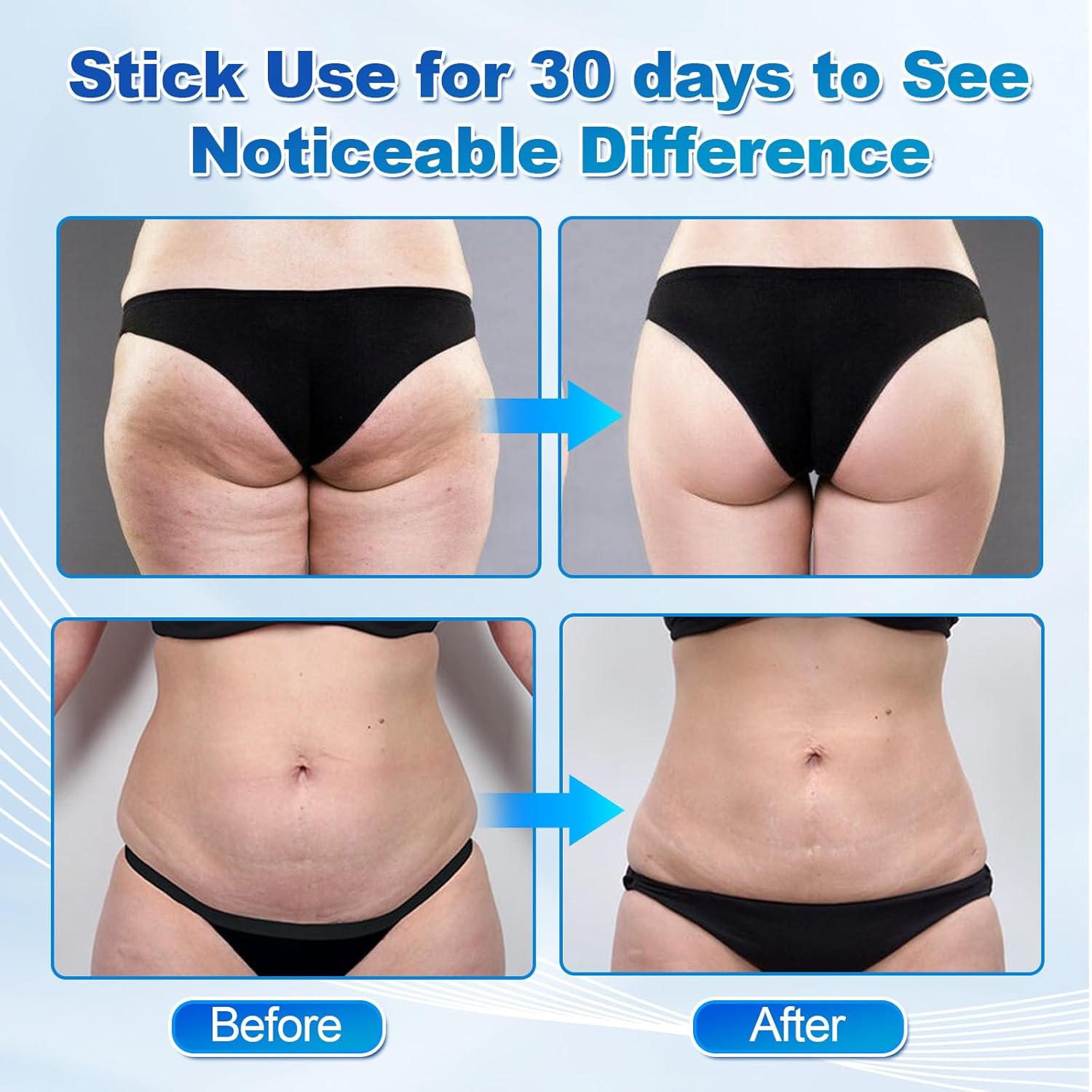 Rkdely 5-in-1 Cupping-Massager: EMS, Rotlicht-Wärme für Cellulite-Behandlung